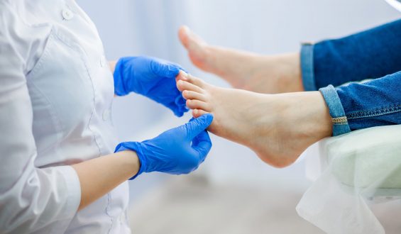 Muitas vezes ignorada, onicomicose é a doença mais comum nas unhas e merece atenção