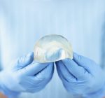 Você conhece a Síndrome ASIA?