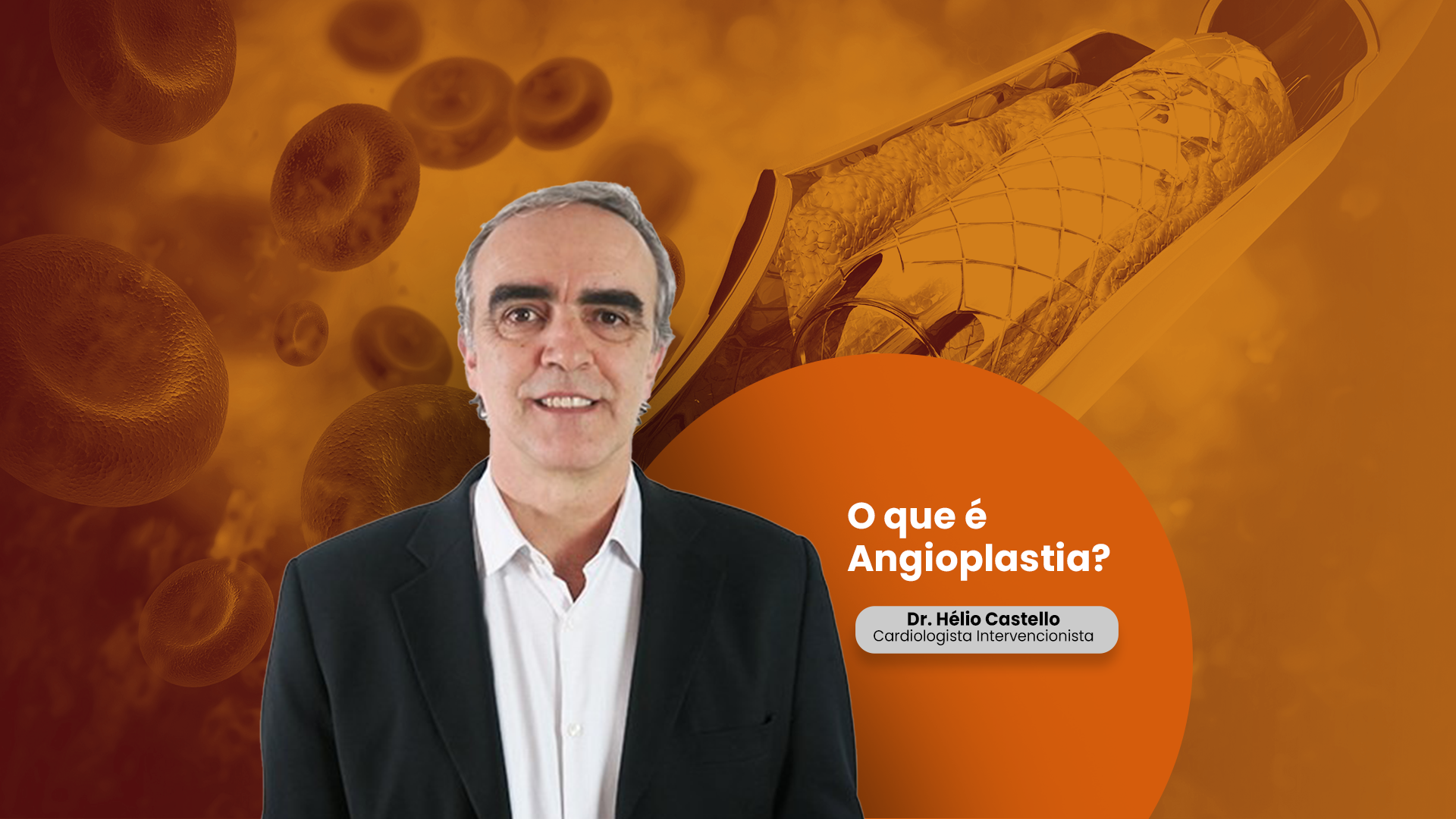 Você sabe o que é angioplastia?