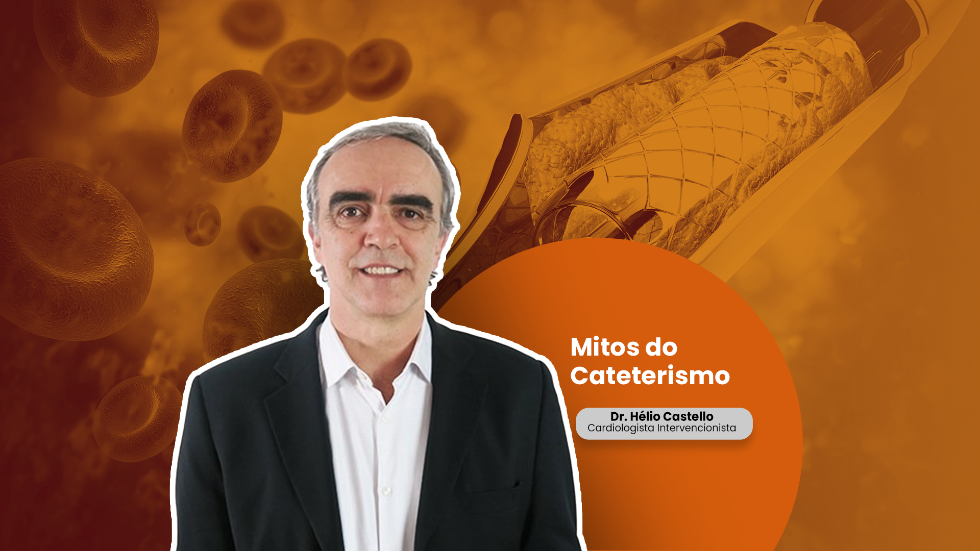 Conheça os principais mitos do Cateterismo