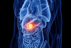Pancreatite: Tipos e sintomas