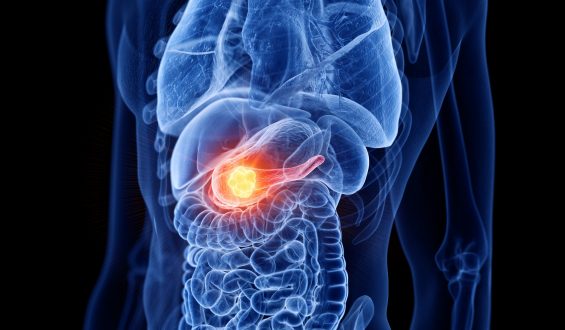 Pancreatite: Tipos e sintomas