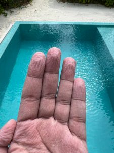 Pele enrugada de um homem adulto que aparentemente acabou de sair da piscina.