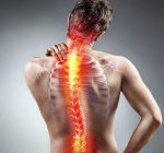 Junho Verde: Mês da Conscientização da Escoliose