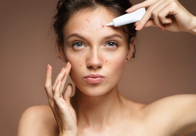 Por que o excesso de maquiagem pode causar acne?