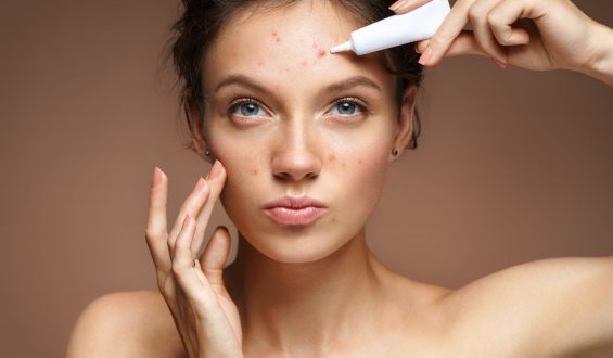 Por que o excesso de maquiagem pode causar acne?