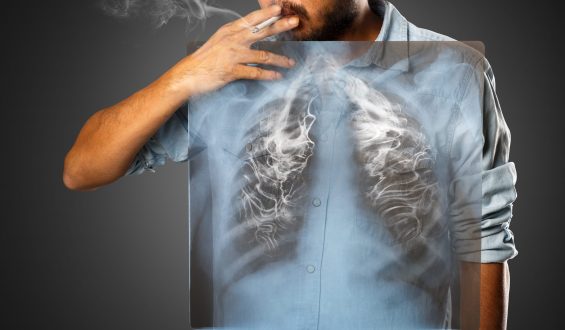 Especial Tabaco: os malefícios do cigarro convencional