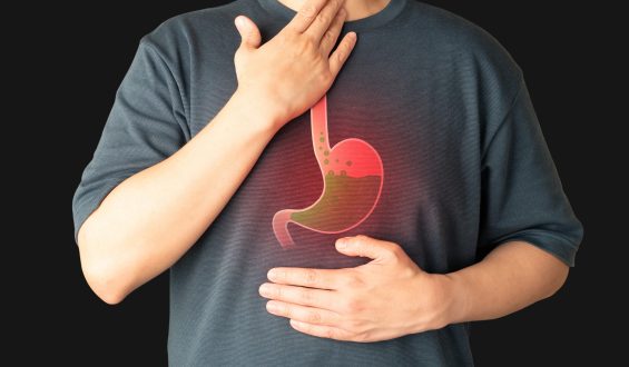 Quando indicar o melhor tratamento para refluxo?