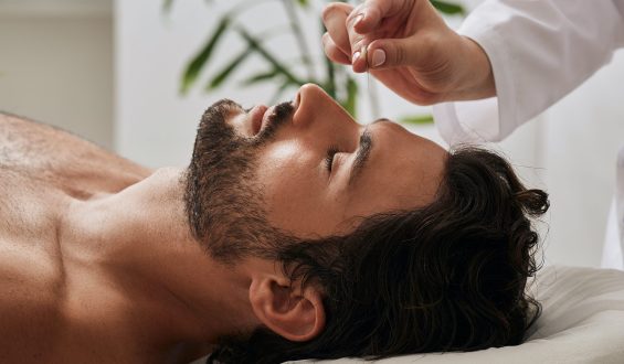 Acupuntura pode ser mais eficaz e segura no tratamento da enxaqueca do que medicamentos