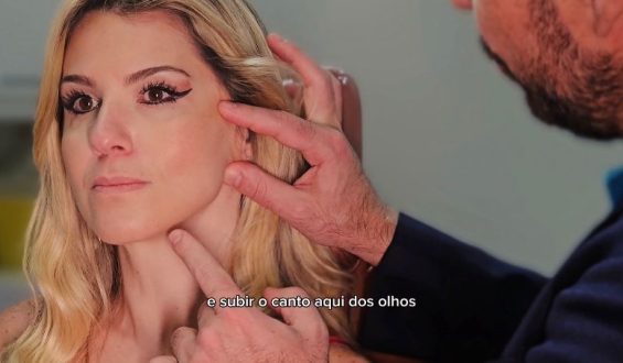 Microlift: conheça a inovadora técnica para acabar com temidas bochechas de bulldog