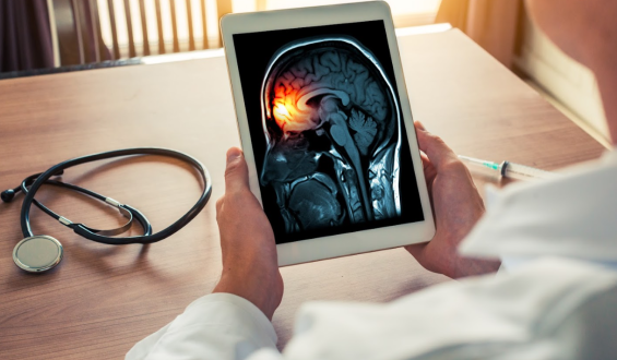 Meningites – Tipos, formas de contágio, e tratamento