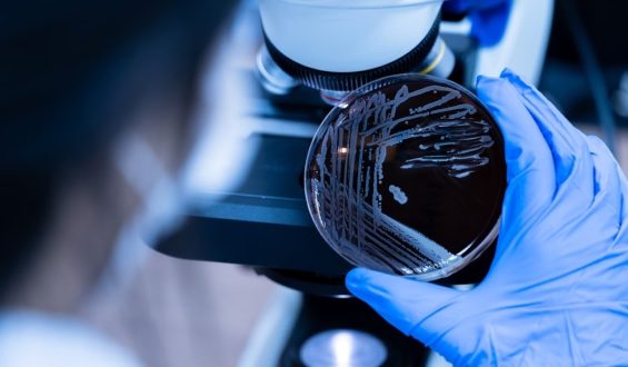 Você sabia que o corpo humano tem mais bactérias do que células?
