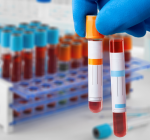 Amanhã, dia 8 de agosto, Dia Nacional de Combate ao Colesterol, o Terminal Rodoviário Tietê terá uma Ação Gratuita de Saúde para você cuidar do seu coração!