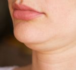 Papada? Ninguém merece!