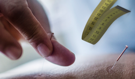 Acupuntura no combate à obesidade