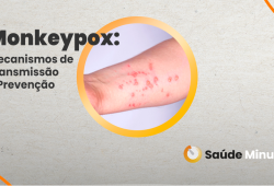 Monkeypox: Mecanismos de Transmissão e Prevenção