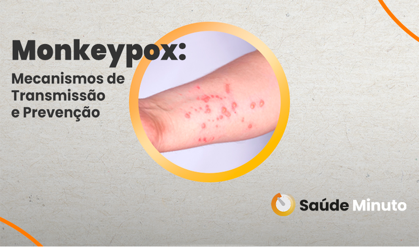 Monkeypox: Mecanismos de Transmissão e Prevenção