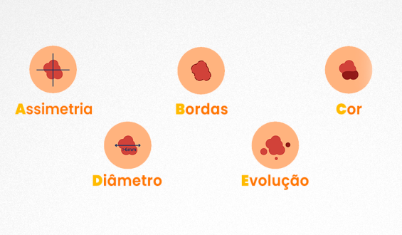 ABCDE das pintas: autoteste te ajuda a se proteger neste verão