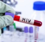 Dezembro Vermelho: novas pesquisas trazem esperança na luta contra o HIV