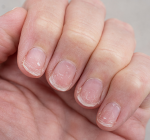 Por que as unhas descamam? Possíveis causas, diagnóstico e tratamento