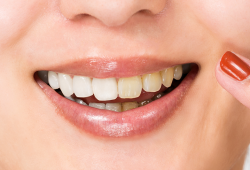 Envelhecimento dos dentes: prevenção e tratamento