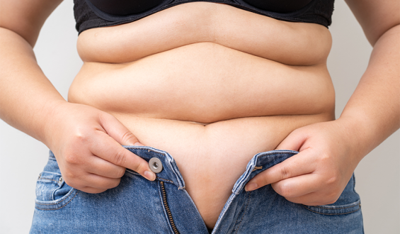 Excesso de gordura abdominal pode desencadear Alzheimer