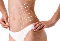 Descubra as inovações tecnológicas na lipoaspiração