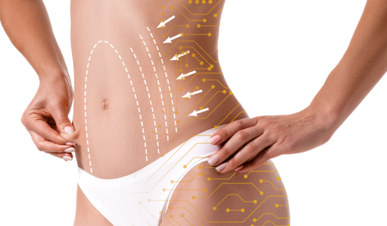 Descubra as inovações tecnológicas na lipoaspiração