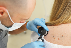 Mapeamento corporal e prevenção do câncer de pele