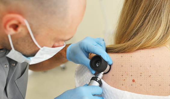 Mapeamento corporal e prevenção do câncer de pele
