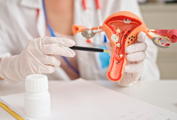 Endometriose: conheça a condição