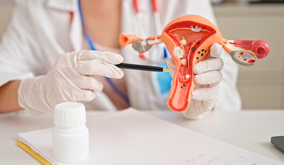 Endometriose: conheça a condição