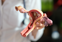Endometriose: doença afeta uma em cada dez mulheres em idade fértil no Brasil