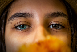 Conheça a Heterocromia