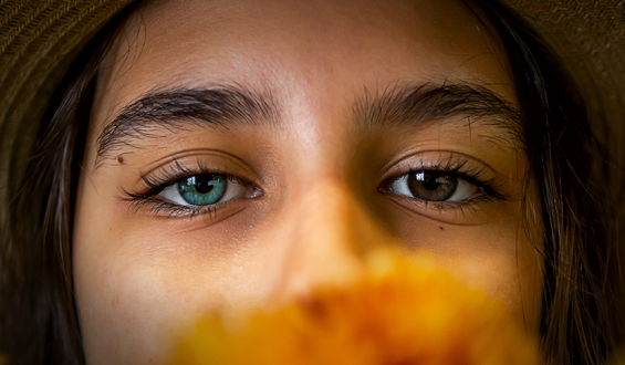 Conheça a Heterocromia