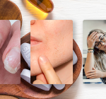 Como identificar deficiências de vitaminas apenas observando pequenos sinais