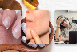 Como identificar deficiências de vitaminas apenas observando pequenos sinais