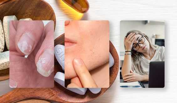 Como identificar deficiências de vitaminas apenas observando pequenos sinais