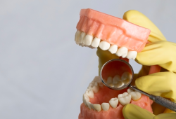 Câncer bucal: prótese dentária mal ajustada pode ser um fator de risco?