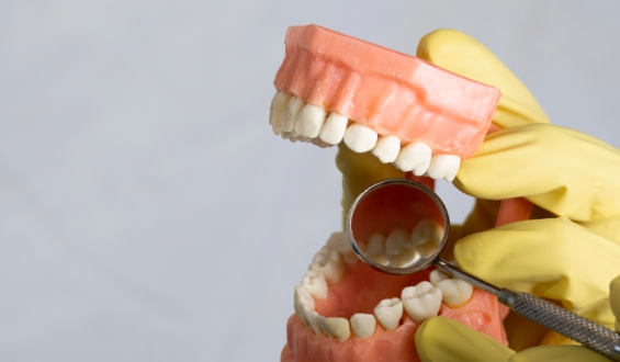 Câncer bucal: prótese dentária mal ajustada pode ser um fator de risco?