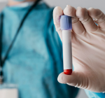 O impacto da diálise vai além do paciente: a importância de acolher as famílias no cuidado renal