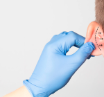 Otoplastia em foco: especialista alerta para os riscos da técnica “sem corte”