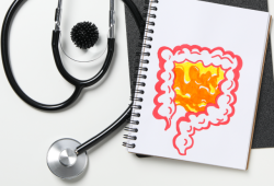 Exercício físico reduz em 28% risco de recidiva do câncer de cólon, revela estudo internacional