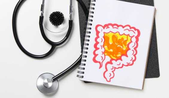 Exercício físico reduz em 28% risco de recidiva do câncer de cólon, revela estudo internacional