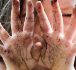 Existe vitamina S de sujeira?