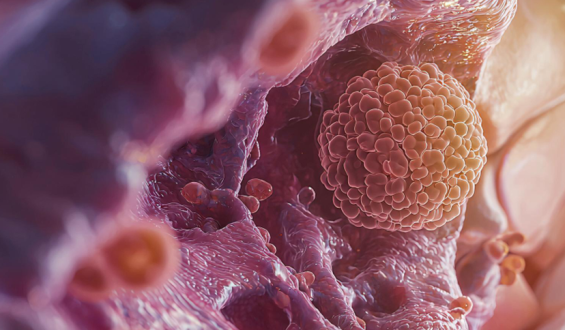 Desinformação e preconceito com exames e vacinas ainda são os  principais gargalos na prevenção do câncer no Brasil