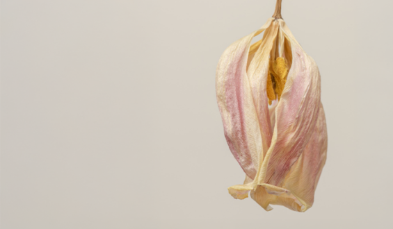 Secura vaginal: quando procurar ajuda profissional? 