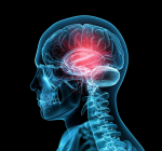 15% dos casos de derrame são em jovens adultos, alerta estudo global