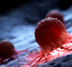 Novo estudo da Fundação do Câncer revela que mais de 60% dos casos de câncer colorretal são diagnosticados em estágios avançados da doença