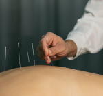 Acupuntura e o estresse do final de ano